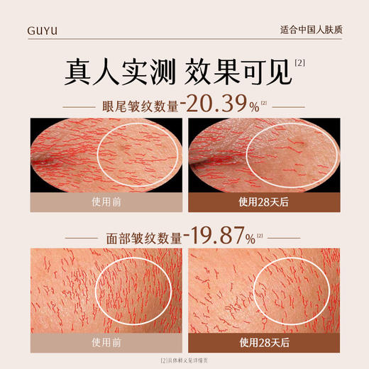 【会员心选】到手100支胶原弹！谷雨黑金针胶原弹 御时极光淡纹祛斑精华液 山参次抛 胶原蛋白+531% 速提拉 久抗垮 商品图2