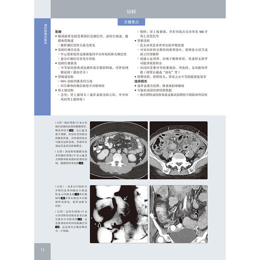 消化影像诊断学（原著第4版） 商品图8