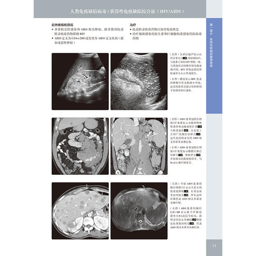 消化影像诊断学（原著第4版） 商品图7