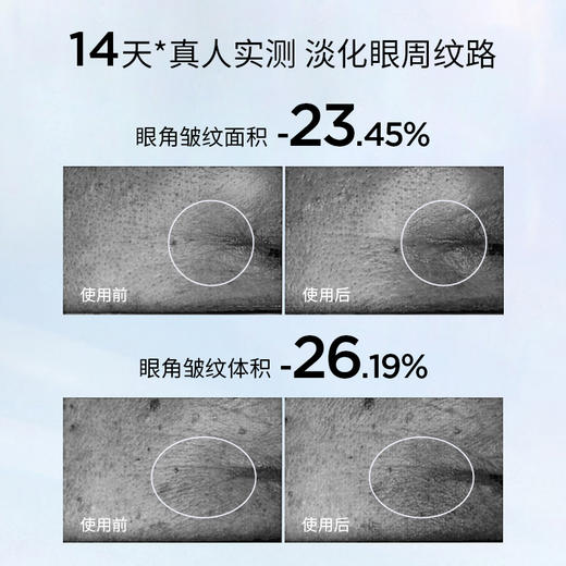 「买30ml🉐️44ml」“眼霜眼精华眼膜”三合一 · 法国Lysedia蓝莲花眼霜眼部保湿精华抗皱紧致大容量眼膜润泽肌肤30ml｜品牌直发 商品图1