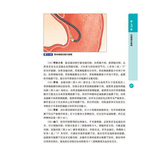 消化道早癌ESD 必备基础与技巧 商品图5