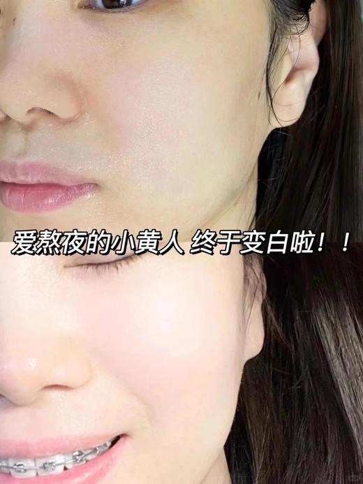 国内专柜新款 sulwhasoo雪花秀滋水乳 单支 补水抗皱滋 润温和爽肤水150ML 乳液125ml 商品图5