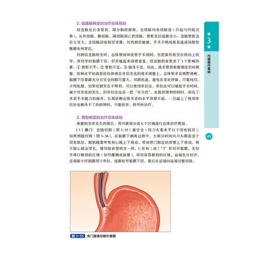 消化道早癌ESD 必备基础与技巧 商品图3