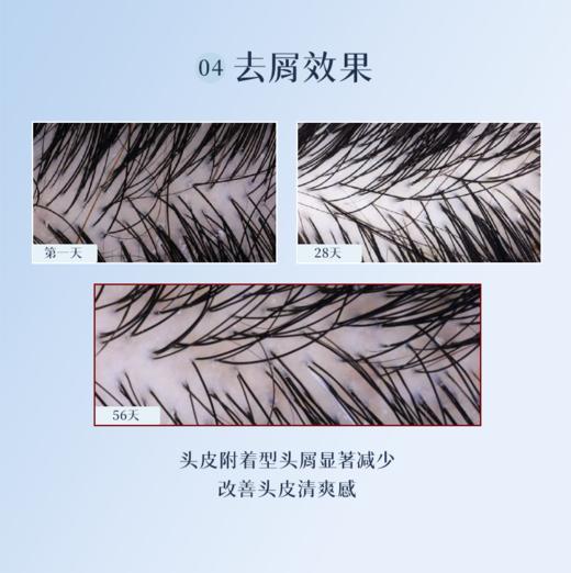 【于小戈】法国药妆PHYTO发朵护发护甲营养胶囊-120粒 商品图5