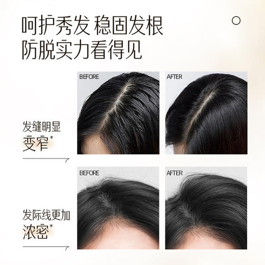 【白药精选】云南白药养元青控油强韧防脱洗发乳210ml+头皮护理液60ml套装护发控油洗头膏长发适用 商品图2