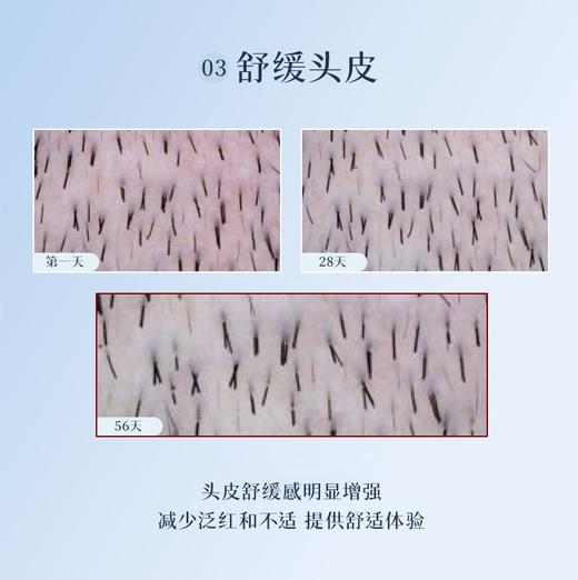 【于小戈】法国药妆PHYTO发朵护发护甲营养胶囊-120粒 商品图4