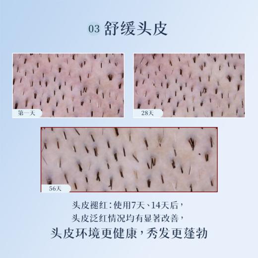 【于小戈】PHYTO发朵女士固发防脱发精华12x5ml  商品图6