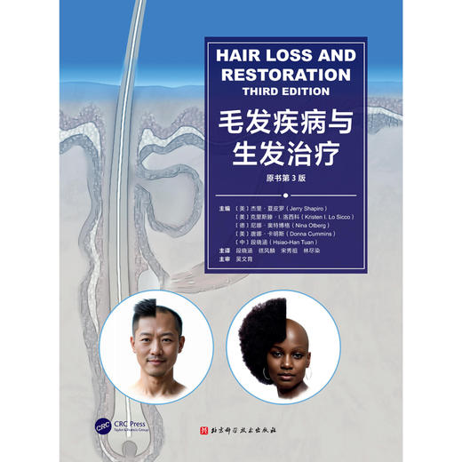 毛发疾病与生发治疗（原书第3版）毛发治疗案头书 商品图1