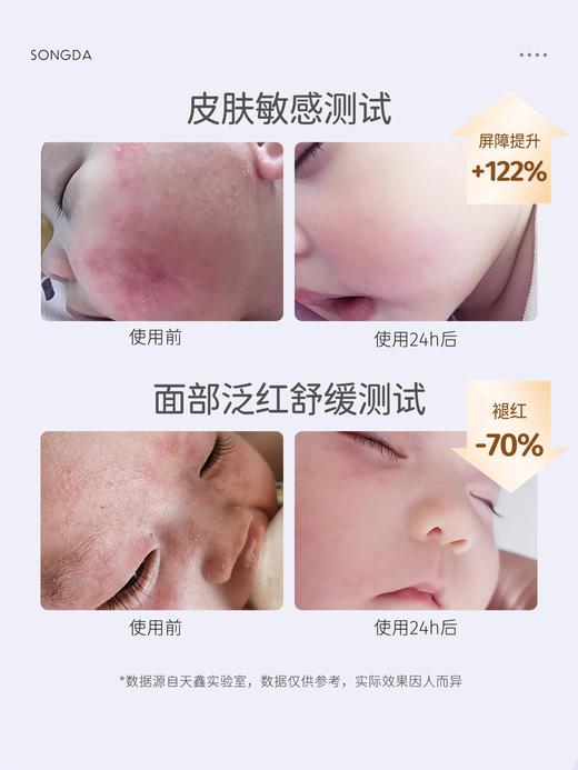 松达婴儿亚麻籽油宝宝舒缓保湿特护霜儿童面霜口水润肤膏滋润补水48g 商品图4