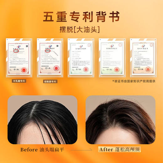 KONO经典洗发套装【控油500ML+净屑500ML+发膜200G】 商品图5