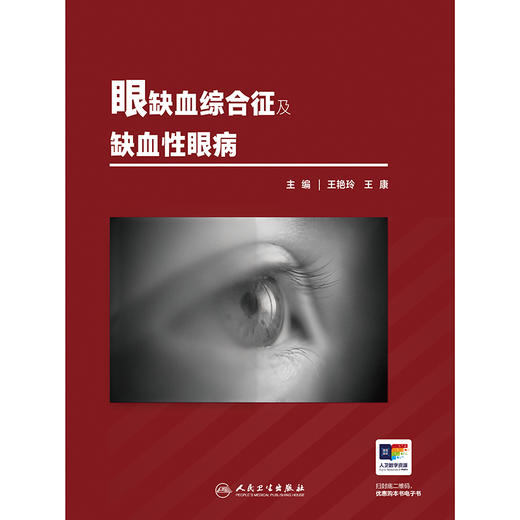 眼缺血综合征及缺血性眼病 商品图1