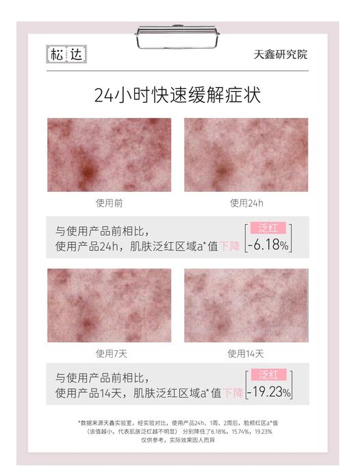 松达婴儿山茶油舒缓特护乳宝宝身体乳新生润肤乳儿童秋冬滋润面霜140g 商品图4