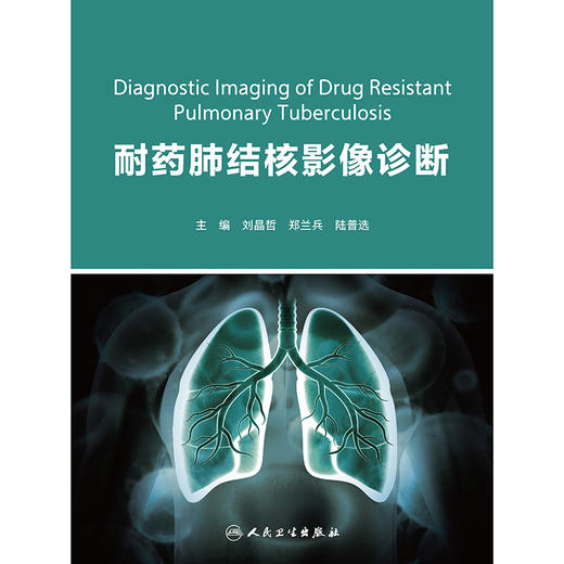 耐药肺结核影像诊断 商品图1