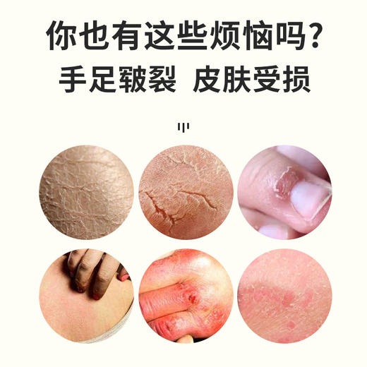超值2盒【滋润保湿❗️柔嫩手足】香港大药房马油皲裂膏 手足防裂脱皮脚后跟干裂防冻滋润保湿修护。ja 商品图2