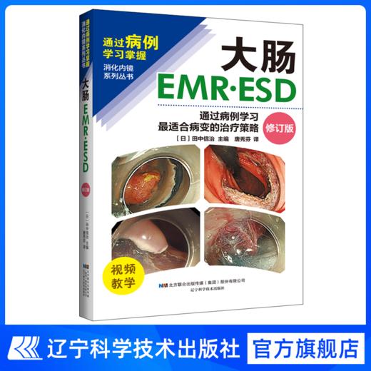 新书现货 大肠EMR•ESD——通过病例学习最适合病变的治疗策略 商品图0