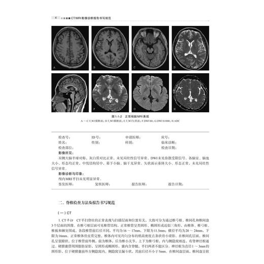 CT/MRI影像诊断报告书写规范 许乙凯 黄婵桃 陈曌 适合影像科及临床各科低年资医师 影像诊断专业学生 研究生参考使用 科学出版社 商品图4