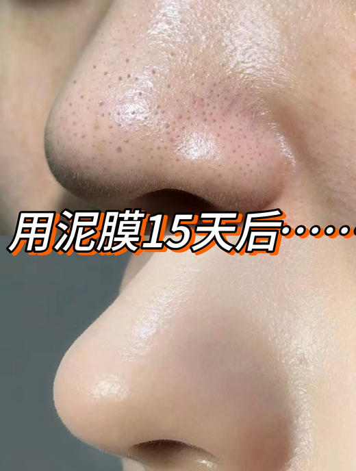 华熙生物-肌活净颜嫩肤调理茶冻泥膜120g/瓶送硅胶刷 商品图6