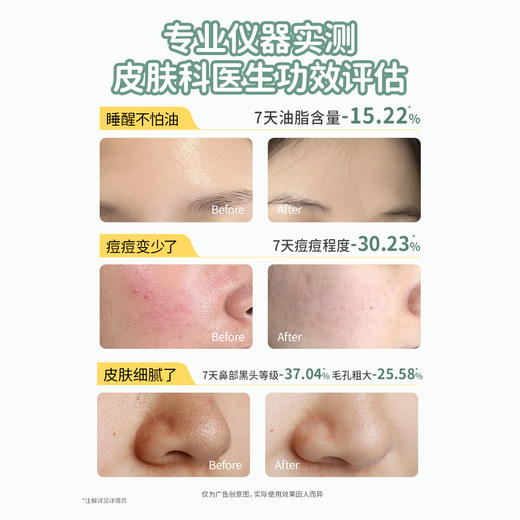 【TOP登陆少年组合同款】青春洗护套组 控油祛痘洁面 去屑控油洗发 商品图3