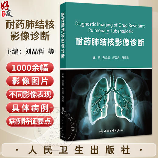 耐药肺结核影像诊断 刘晶哲 郑兰兵 陆普选 重点阐述了五种类型耐药肺结核影像学表现特点及影像诊断 9787117373319人民卫生出版社 商品图0