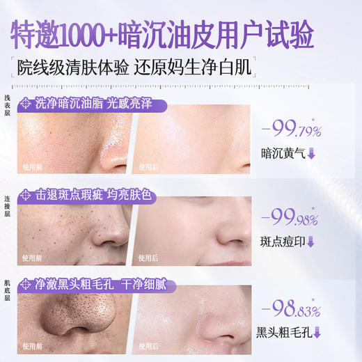 儒意特护美白洁面乳200g 377美白洗面奶氨基酸控油淡斑深层清洁收缩毛孔男士女专用洁面乳|儒意官方商城 商品图3