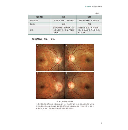 中山眼科中心疑难病例荟萃 2025版 中山眼科疑难眼病系列 林浩添 本书将既往中山眼科论坛和全院病例讨论的疑难等 人民卫生出版社 商品图4