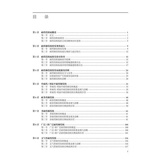 耐药肺结核影像诊断 刘晶哲 郑兰兵 陆普选 重点阐述了五种类型耐药肺结核影像学表现特点及影像诊断 9787117373319人民卫生出版社 商品图3