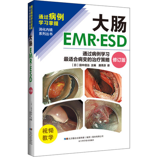 新书现货 大肠EMR•ESD——通过病例学习最适合病变的治疗策略 商品图1