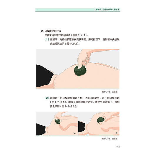 常见训练伤非药物自治互治手册 关玲 主编 实用性强 图片 视频丰富 所述治疗方法易学易用 中国医学 9787117385596 人民卫生出版社 商品图4