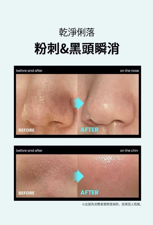 韩国 Ilso 黑头导出液150ml+化妆棉40片 商品图3