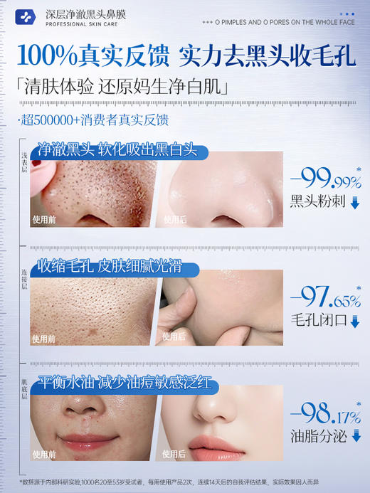 【1敷走黑白头 控油收毛孔】水杨酸去黑头收缩毛孔粉刺深层清洁鼻膜鼻贴吸祛撕拉面膜神器男女 商品图1