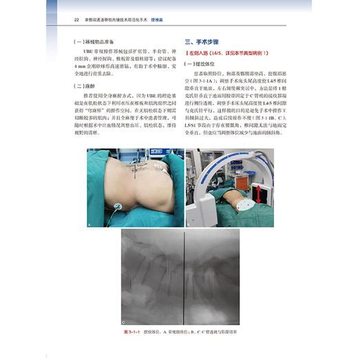 单侧双通道脊柱内镜技术规范化手术：腰椎篇 杨贺军 系统构建标准化操作体系 融合真实病例经验与精准影响解析 北京大学医学出版社 商品图4