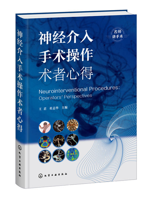 神经介入手术操作术者心得 商品图0