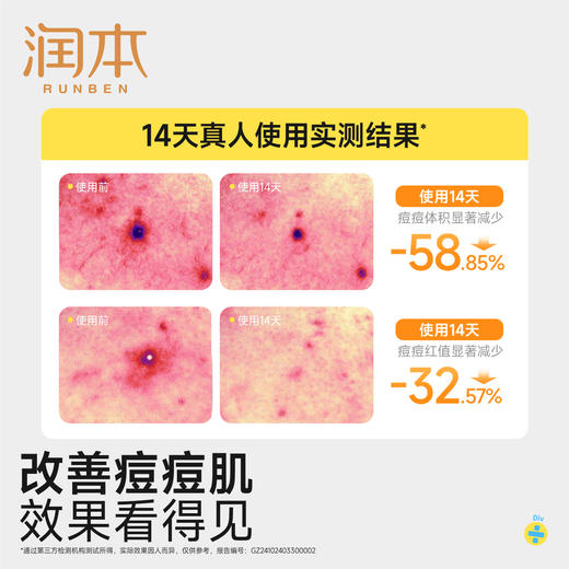 润本青少年控油祛痘沐浴露 清洁后背痘男生女生洗护专用沐浴 商品图2