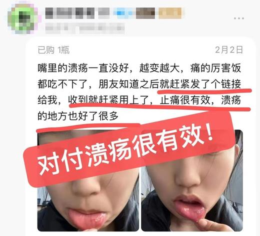 【多妈团购 Breathy布雷辛舒口宁口腔喷雾】溃疡肿痛，一喷很快就不痛了，10秒成膜·冰镇舒缓，喝水无痛，牙龈肿痛/咽喉不适，快速修护，修复黏膜·长效防护-美初 商品图9