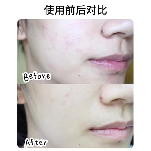 【原盒原码 防伪可查】修丽可植萃舒缓修护精华30ml色修精华（效期26年12月） 商品图3