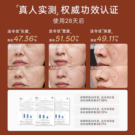 京度Kingdo 三效法令纹修护仪 K3-13KA（二代） 商品图2