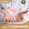 TCT宫颈分泌物检查 商品缩略图0