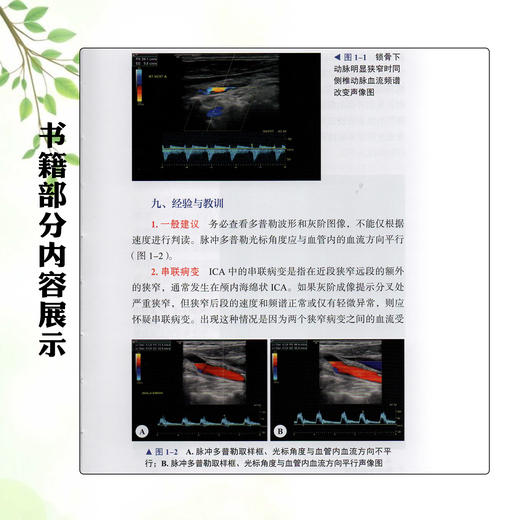 麻省总医院血管超声临床规范 方案与流程 黄品同 何文 主译 血管超声领域国际经典 临床操作规范一册精通 中国科学技术出版社 商品图3