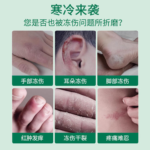 【超值4罐装】德国品牌 HEALMUSZ 獾油烧伤冻伤膏 草本配方 长效修护 25g*4罐 商品图1