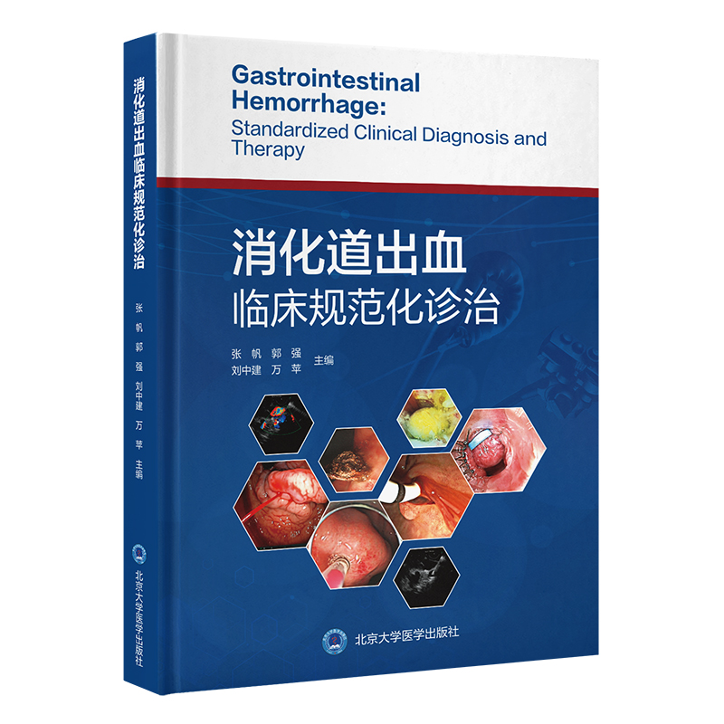 消化道出血临床规范化诊治