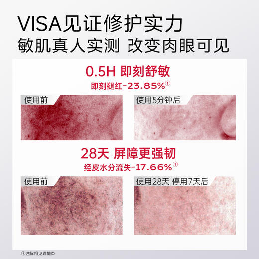 优理氏酵母修护精华水 爽肤水补水保湿护肤水湿敷舒缓 商品图3