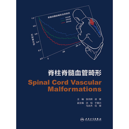 脊柱脊髓血管畸形 商品图1