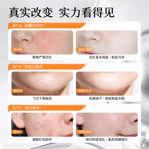 【油性肌肤】油橄榄舒缓调理喷雾 50ml 商品图3