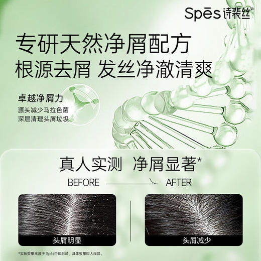 【分仓直发包邮】Spēs诗裴丝胶原青蒿去屑蓬松洗发露750ml 商品图4