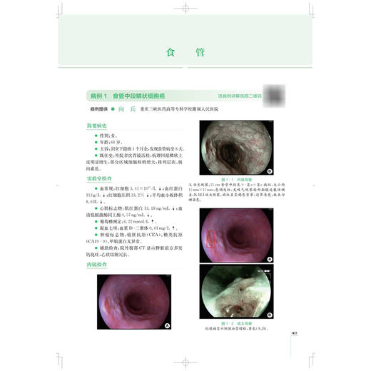 超声内镜临床应用 中国介入性EUS视频大赛 优秀病例精析 金震东 主编 涵盖超声微探头及介入性EUS两大领域 上海科学技术出版社 商品图4