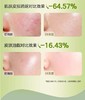 纽强控油祛痘净颜洁面乳(女生专用)  100g 商品缩略图1