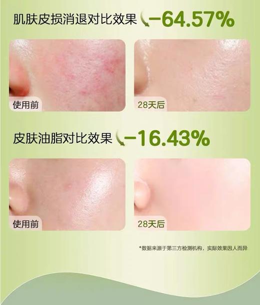 纽强控油祛痘净颜洁面乳(女生专用)  100g 商品图1