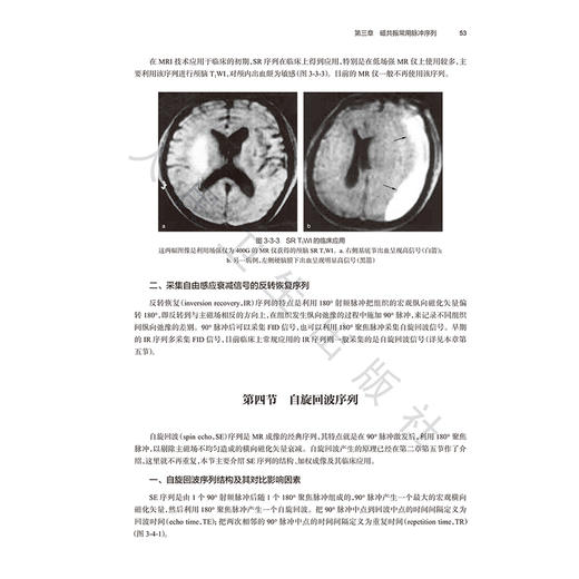 临床磁共振成像系列丛书 设备与技术分册 杨正汉 主编 以通俗易懂的方式详细MRI原理及脉冲序列 9787117374064 人民卫生出版社 商品图4