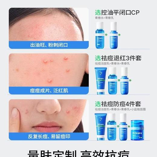 海龟爸爸青少年祛痘水乳护肤套装 男学生青春期女孩控油儿童洗面奶 商品图5