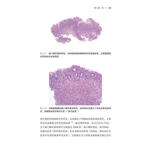 消化道黏膜病理活检解读（原书第3版） 商品图4